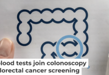 Screening is essential to prevent and effectively treat colorectal cancer. Varlay/iStock via Getty Images Plus
